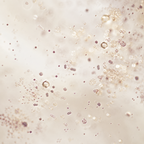 Bifidobacterium lactis